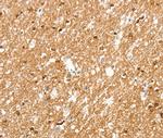 AMZ1 Polyclonal Antibody