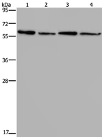 CD297 Antibody in Western Blot (WB)