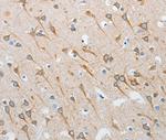 INTS1 Polyclonal Antibody
