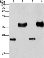 LIN28B Polyclonal Antibody