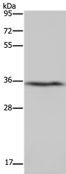 DDAH1 Antibody in Western Blot (WB)