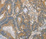 DGKZ Antibody in Immunohistochemistry (Paraffin) (IHC (P))