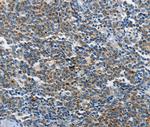 NEK1 Antibody in Immunohistochemistry (Paraffin) (IHC (P))
