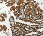 SERPINA9 Polyclonal Antibody