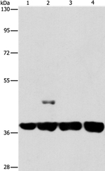 SERPINA9 Antibody in Western Blot (WB)