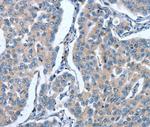 GINS1 Polyclonal Antibody