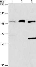 ASCC2 Polyclonal Antibody