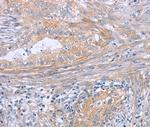 FAM44B Polyclonal Antibody