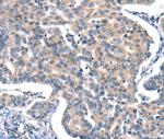 CaV2.1 Polyclonal Antibody