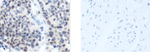 CAMTA1 Antibody in Immunohistochemistry (Paraffin) (IHC (P))