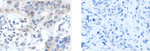 CAMTA1 Antibody in Immunohistochemistry (Paraffin) (IHC (P))