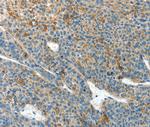 CLPTM1L Antibody in Immunohistochemistry (Paraffin) (IHC (P))