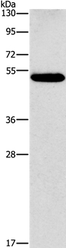 CALCRL Antibody in Western Blot (WB)