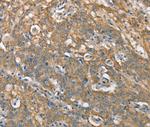 CSMD1 Antibody in Immunohistochemistry (Paraffin) (IHC (P))