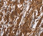 NY-ESO-1 Antibody in Immunohistochemistry (Paraffin) (IHC (P))