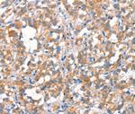 MT-CYB Antibody in Immunohistochemistry (Paraffin) (IHC (P))