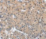 DSC1 Antibody in Immunohistochemistry (Paraffin) (IHC (P))