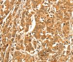DIRAS1 Antibody in Immunohistochemistry (Paraffin) (IHC (P))