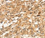DIRAS1 Polyclonal Antibody