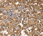 AGO1 Antibody in Immunohistochemistry (Paraffin) (IHC (P))