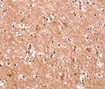 ENPP4 Polyclonal Antibody