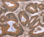 EAP2 Polyclonal Antibody