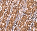 FAM13B Antibody in Immunohistochemistry (Paraffin) (IHC (P))