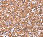 FAM13B Antibody in Immunohistochemistry (Paraffin) (IHC (P))