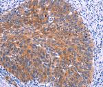 PTPN13 Antibody in Immunohistochemistry (Paraffin) (IHC (P))