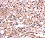 PTPN13 Antibody in Immunohistochemistry (Paraffin) (IHC (P))