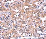 FAT1 Polyclonal Antibody