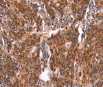 FEM1A Antibody in Immunohistochemistry (Paraffin) (IHC (P))