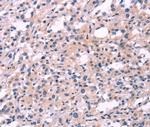 FGF16 Polyclonal Antibody