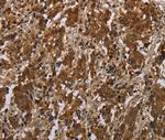 FGF20 Polyclonal Antibody