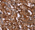 GAGE12I Polyclonal Antibody
