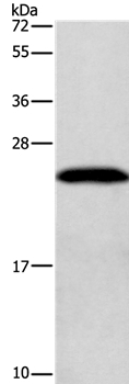 GAGE12I Antibody in Western Blot (WB)