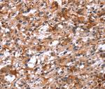 Glucagon Receptor Polyclonal Antibody