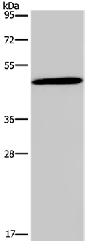 Glucagon Receptor Antibody in Western Blot (WB)