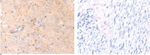 HCAR2 Polyclonal Antibody