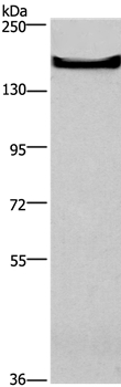 TEM5 Antibody in Western Blot (WB)