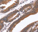 GREB1 Antibody in Immunohistochemistry (Paraffin) (IHC (P))