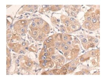 HAS1 Polyclonal Antibody
