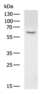 HAS1 Antibody in Western Blot (WB)