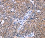 HDBP2 Polyclonal Antibody