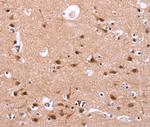 HIPK1 Antibody in Immunohistochemistry (Paraffin) (IHC (P))