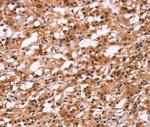 HIPK1 Polyclonal Antibody