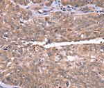 HRG Polyclonal Antibody