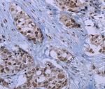ID3 Polyclonal Antibody