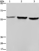 Synapsin 2 Antibody in Western Blot (WB)