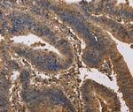 KCNG1 Antibody in Immunohistochemistry (Paraffin) (IHC (P))